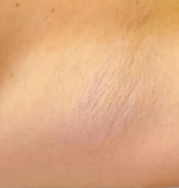 Hair-Removal-after2-574x600.jpg