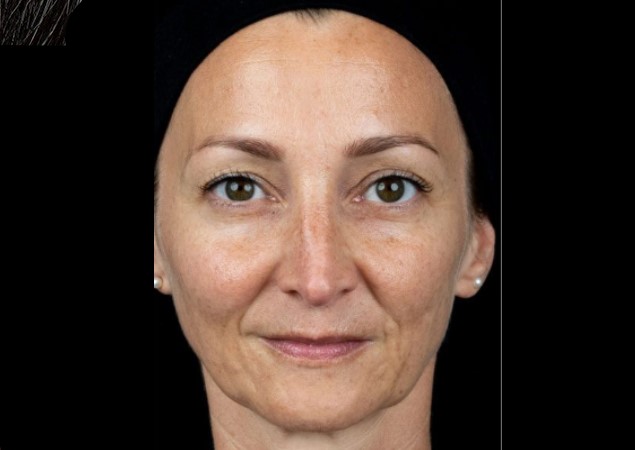 transformation-img-4